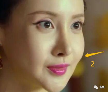 容东王妃整形吃瓜,揭秘明星美容背后的真相